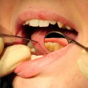 File photo. Dentists in Wales and England have abandoned free treatments over growing frustration with the NHS dental contract, the BDA warns. Picture: Rui Vieira/PA Wire