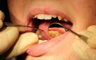 File photo. Dentists in Wales and England have abandoned free treatments over growing frustration with the NHS dental contract, the BDA warns. Picture: Rui Vieira/PA Wire